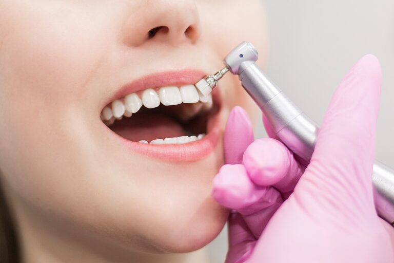 dentist brushes teeth young girl teeth whitening utc