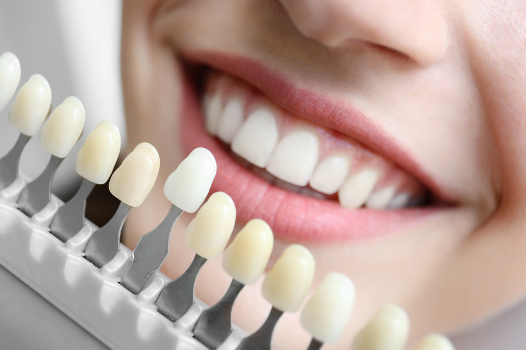 Young woman choosing color of teeth at dentist