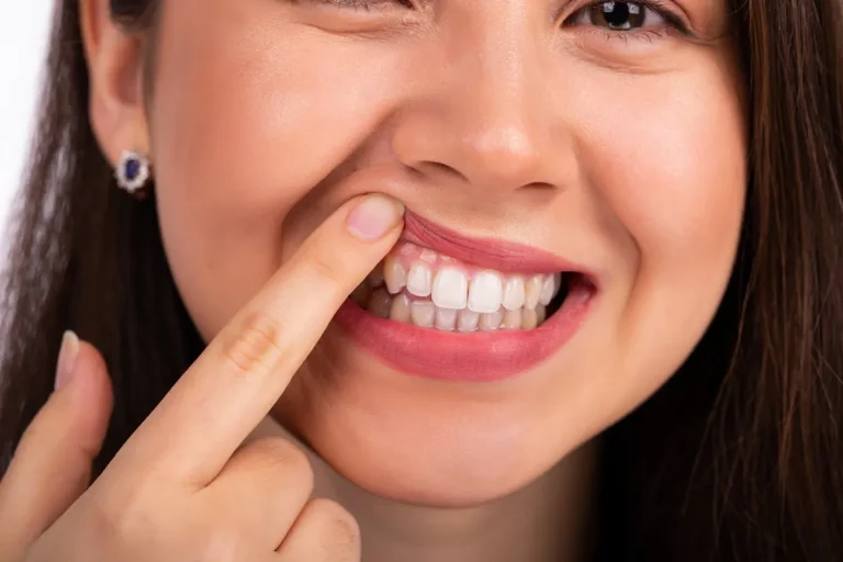 Young beautiful woman touches her teeth on the upper jaw with her finger, showing a problem with the teeth or gums.