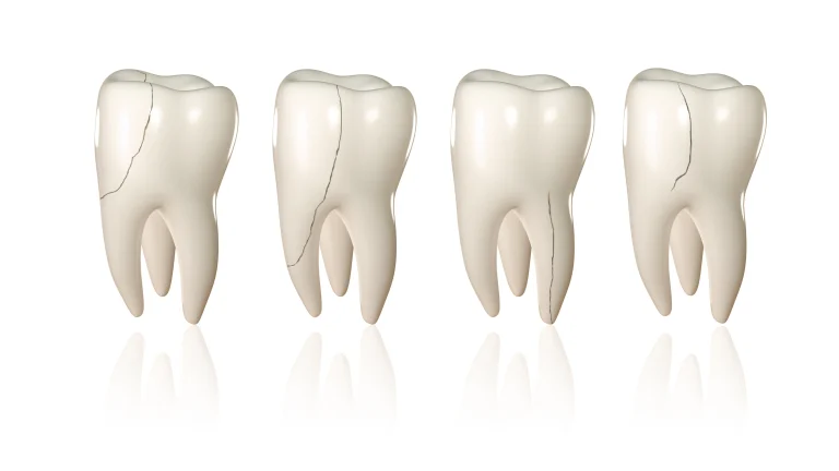 3D images of teeth
